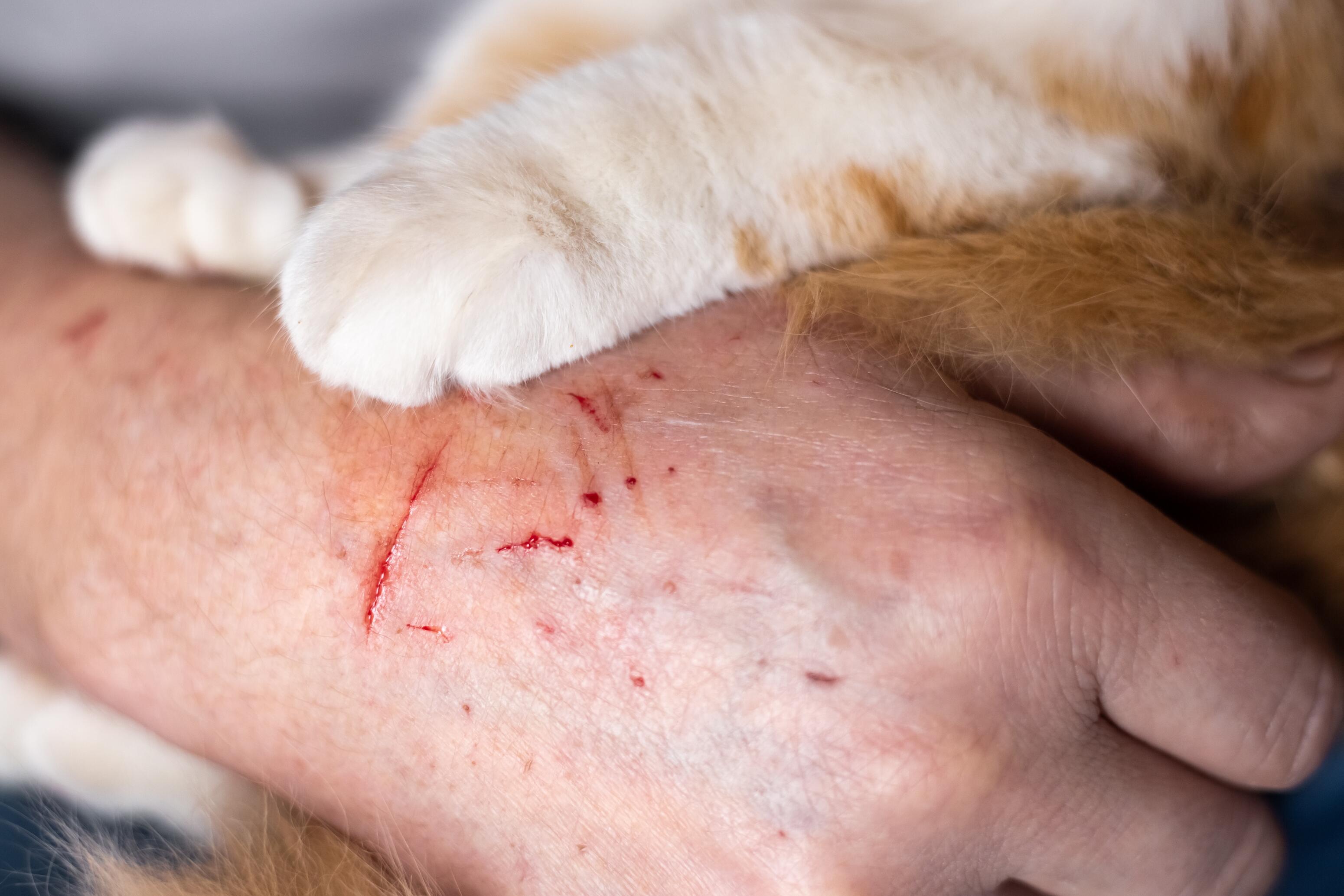désinfecter une plaie de piqûre ou morsure